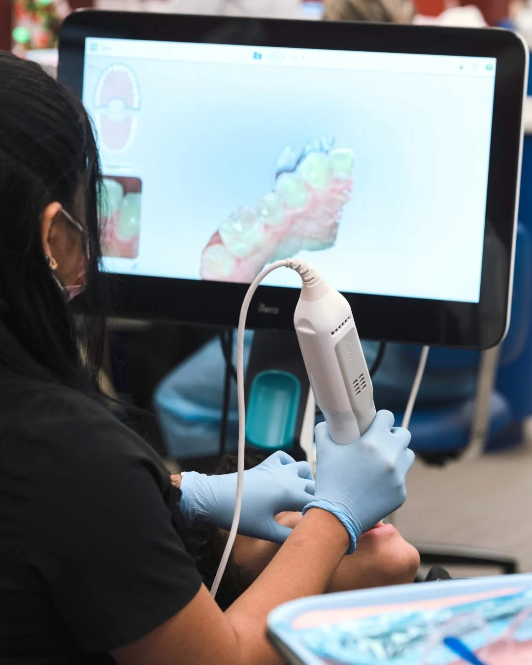 3D Dental Scanner in Pirangut Pune