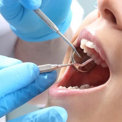 Cosmetic Dentist in Pirangut | Smile Makeover